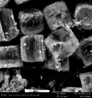 Electron micrograph diatoms